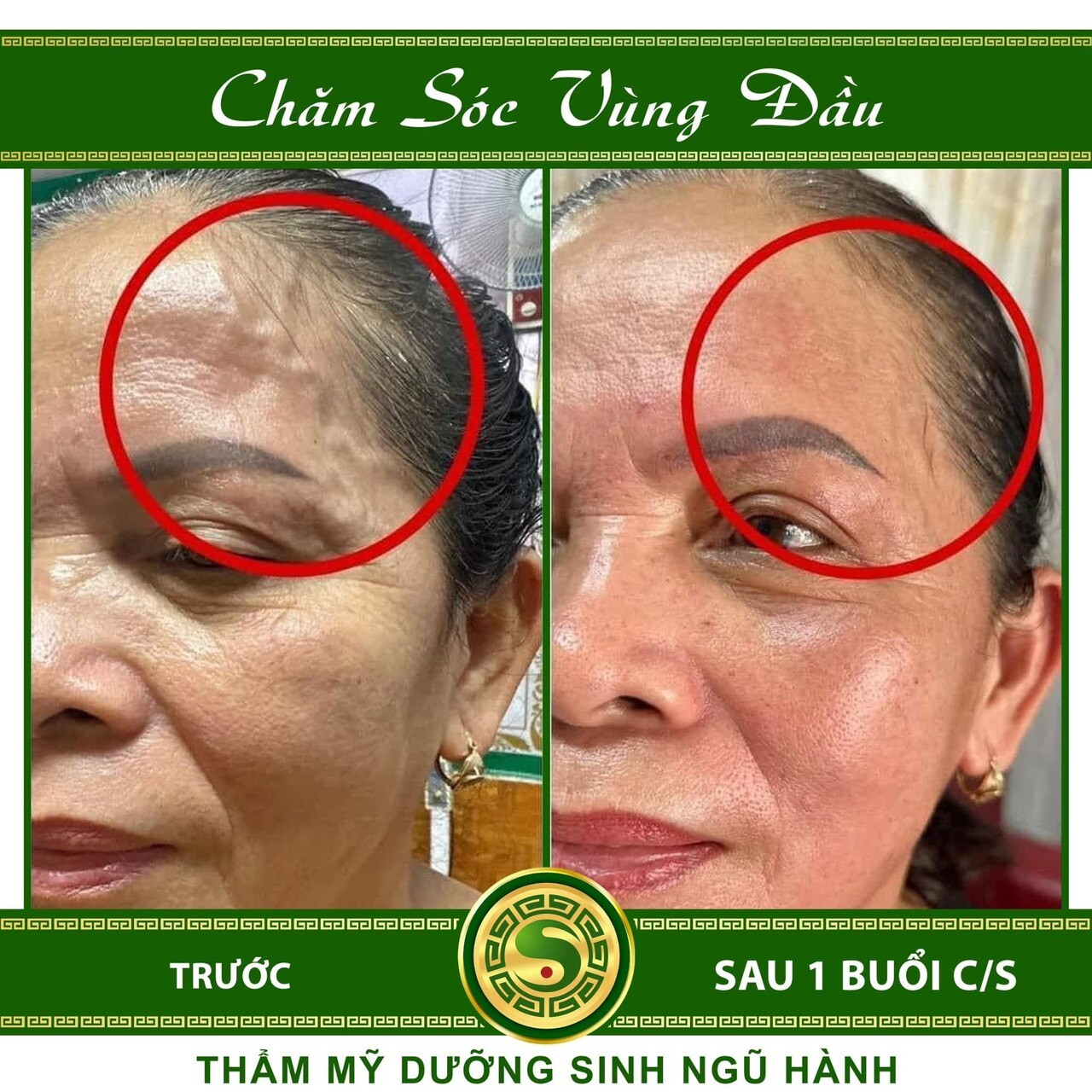 Chăm Sóc Vùng Đầu - Ảnh 1