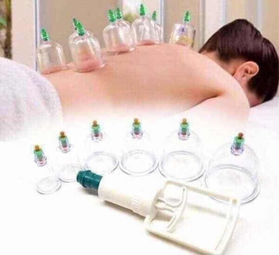 BỘ GIÁC HƠI 12 ỐNG KHÔNG DÙNG LỬA