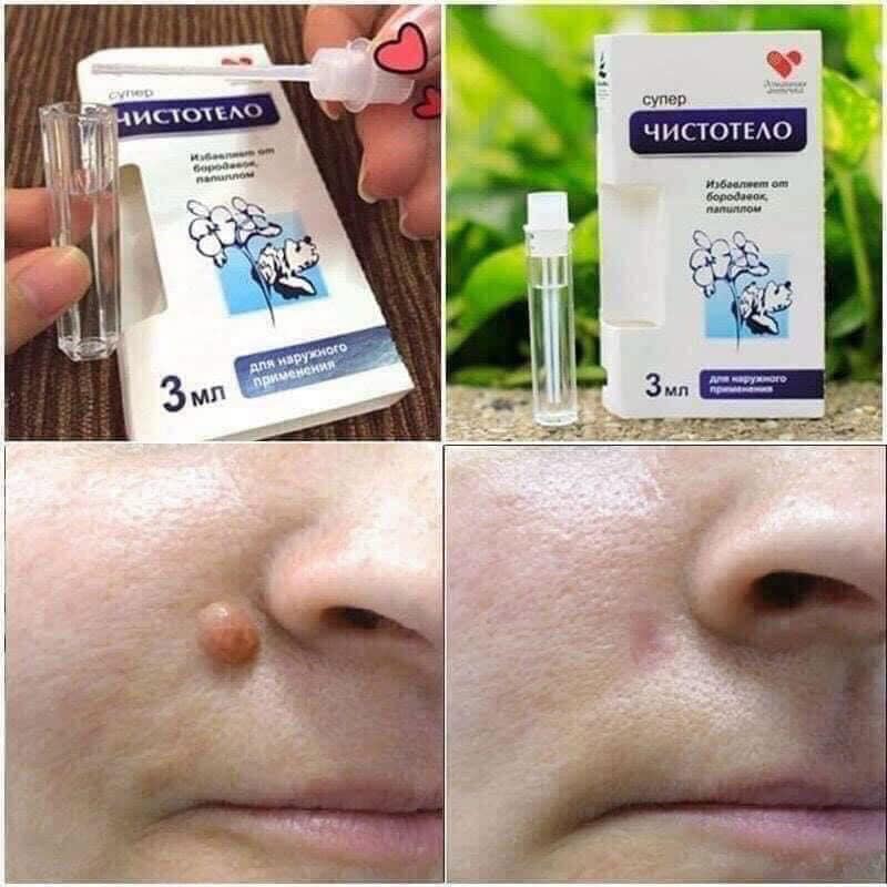 Gel tẩy tế bào chết, mụn thịt, mụn cơm, mụn cóc.... - Ảnh 1