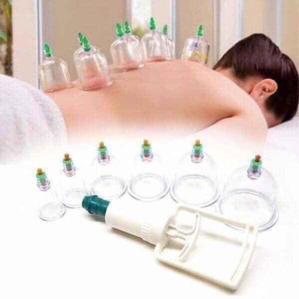 BỘ GIÁC HƠI 12 ỐNG KHÔNG DÙNG LỬA - Ảnh 1